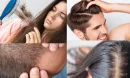 Saç Dökülmesinin Yaygınlığı ve Nedenleri