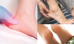 Topuk Ağrısı Çekenler İçin Kendi Deneyimlerim ve Kurtuluş Yolum