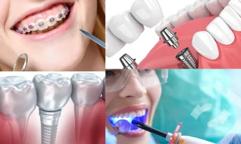 Düzce İmplant Tedavisi Nasıl Yapılır?