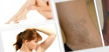 You Can Get Rid of Tattoos That Bother You and Have Become Boring