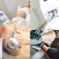 Soğuk Lipolinizin Kullanım Alanları